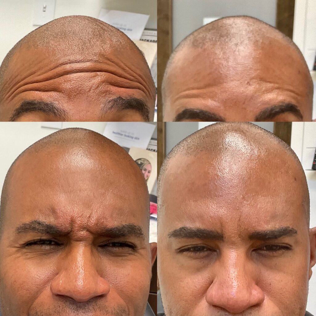 424FCE31-CED0-4274-BEDA-ACB2FC306F54